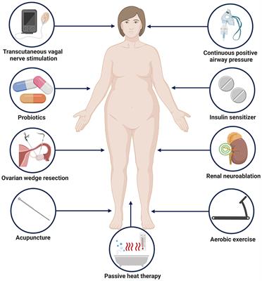 The role of the autonomic nervous system in polycystic ovary syndrome